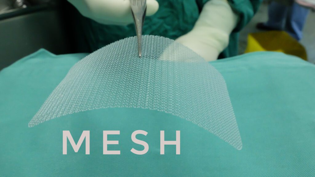 medical professional holding mesh with pliers